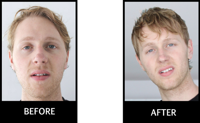 before-after-31